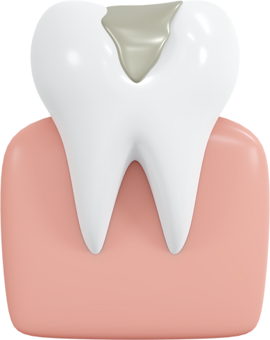 3D icon tooth decay filled with titanium